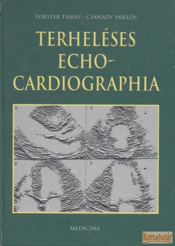 Terheléses echocardiographia